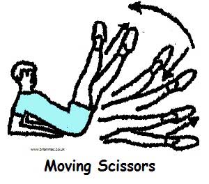 Moving scissors